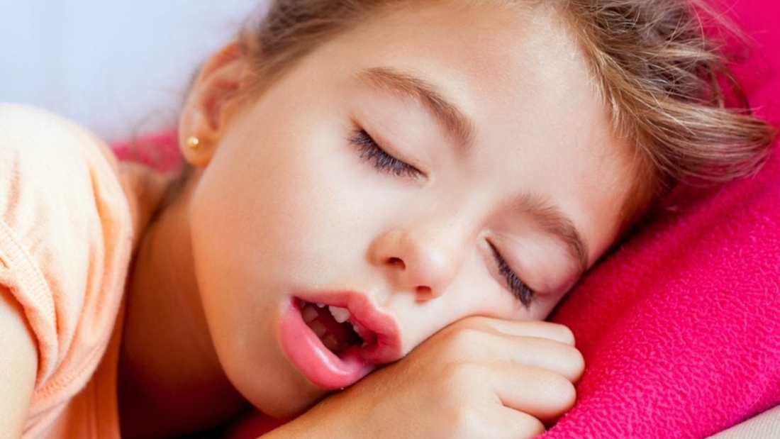 Young child sleeping with mouth open showing common mouth breathing during sleep